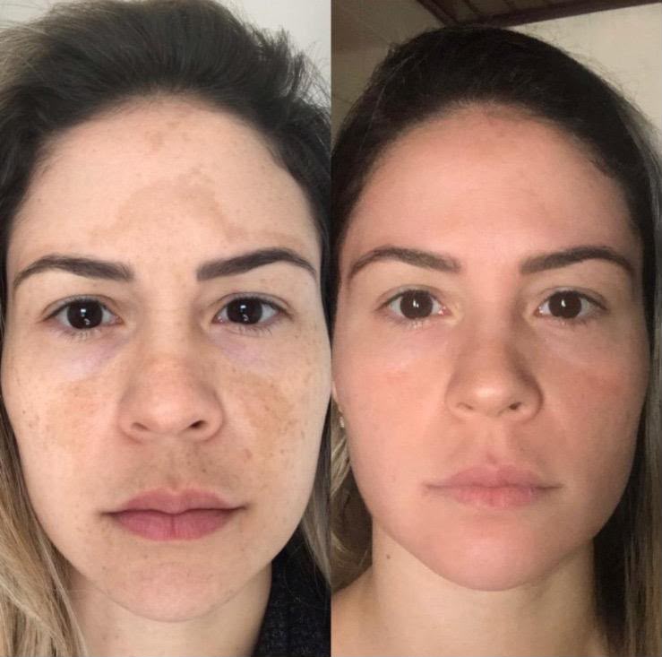 Programa Pele Renovada — Fabiana Rocha Centro de Estética